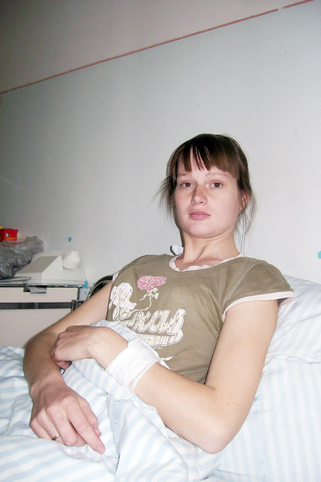 Erkė sujaukė pavasarį Erkė sujaukė pavasarį