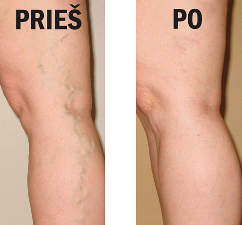 Gražios ir sveikos kojos Gražios ir sveikos kojos